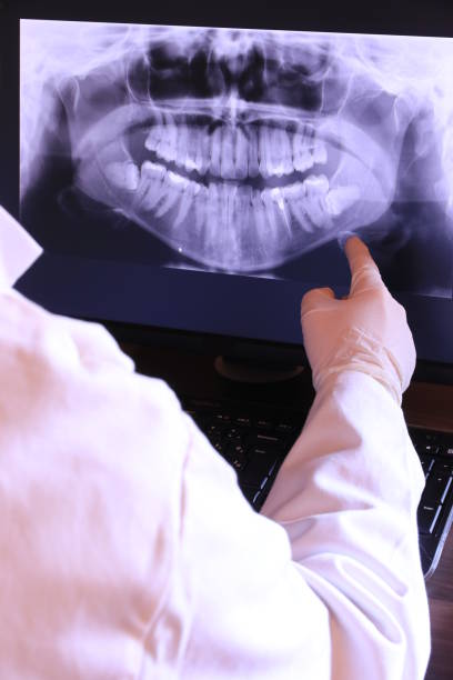Best Emergency Root Canal Therapy in Dunkirk, IN